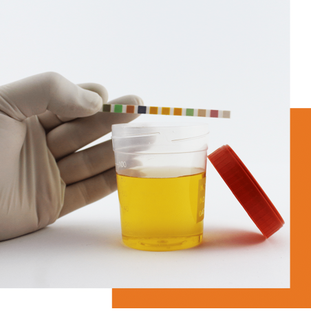 Bandelette urinaire URITOP+